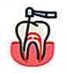 endodoncia clínica renueva dental. león 
